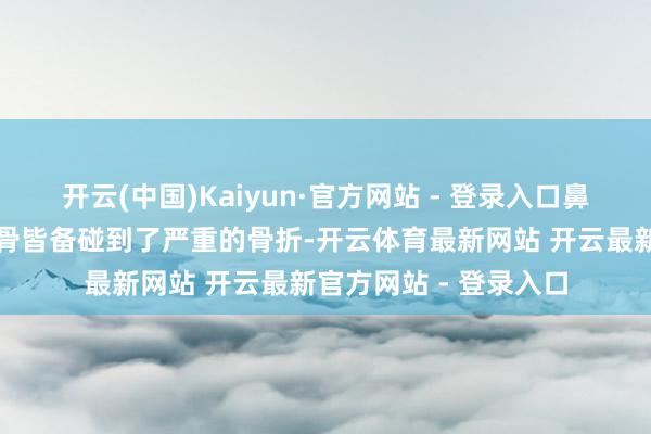 开云(中国)Kaiyun·官方网站 - 登录入口鼻子、颧骨、双手和肋骨皆备碰到了严重的骨折-开云体育最新网站 开云最新官方网站 - 登录入口